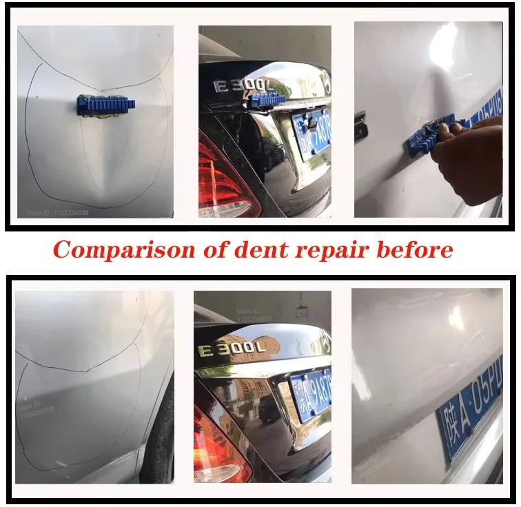 Dent Repair Tool Set Car Dents | Stornfield