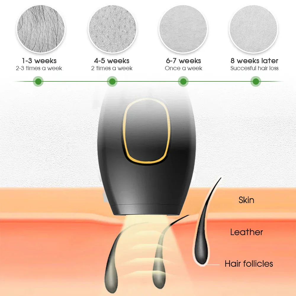 Stornfield | Bikini IPL 500,000 Flash Painless Permanent Laser Hair Removal for Women Home Hair Removal Devices