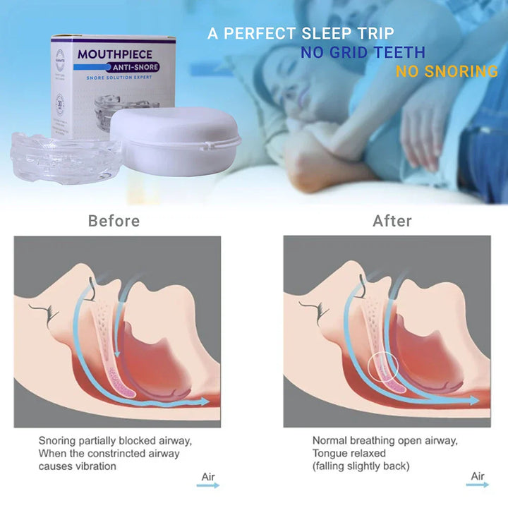 Stornfield | Apnée de sommeil embout buccal