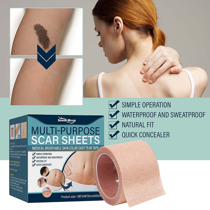 Soft Silicone Gel Tape for Scar Removal | Stornfield
