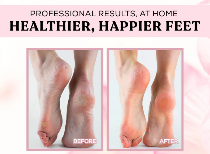 Gentle callus removal | Strong protection for your feet | Stornfield