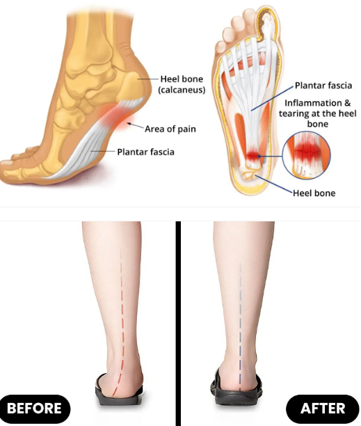 Orthopedic Insole | Soft, Supportive, Breathable | Stornfield