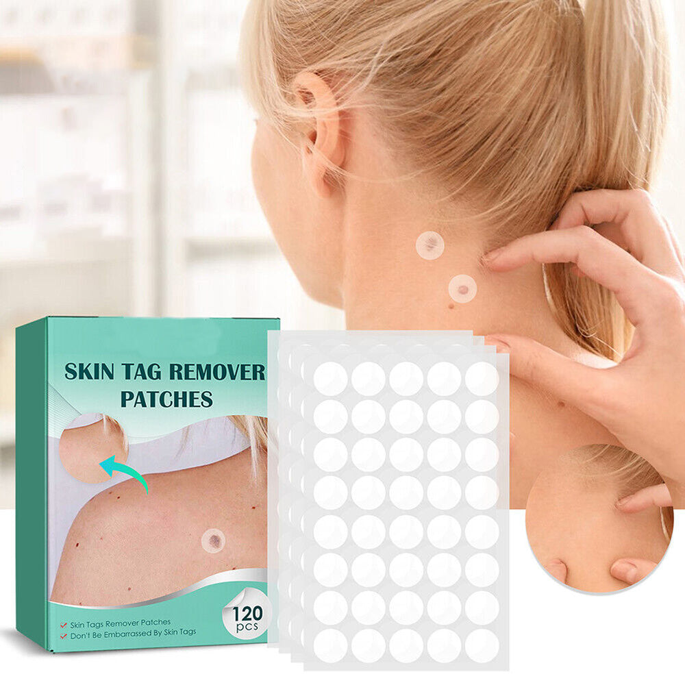 Stornfield | SkinClear - Plaster for the removal of spots and warts