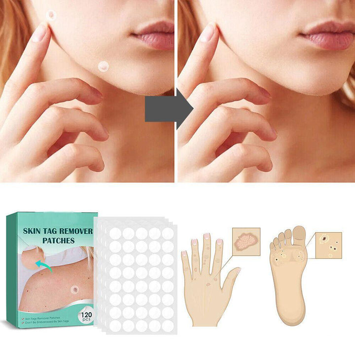 Stornfield | SkinClear - Plaster for the removal of spots and warts