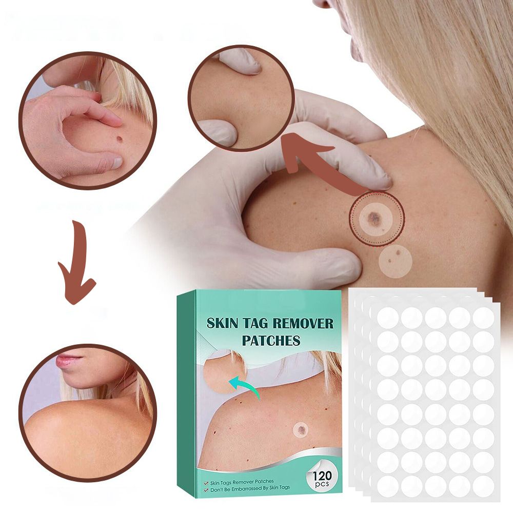 Stornfield | SkinClear - Plaster for the removal of spots and warts