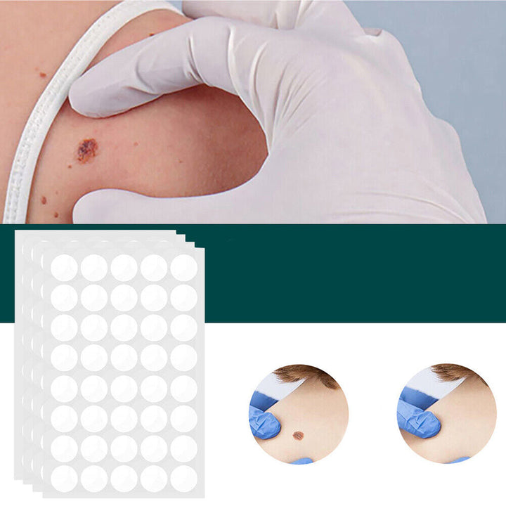Stornfield | SkinClear - Plaster for the removal of spots and warts