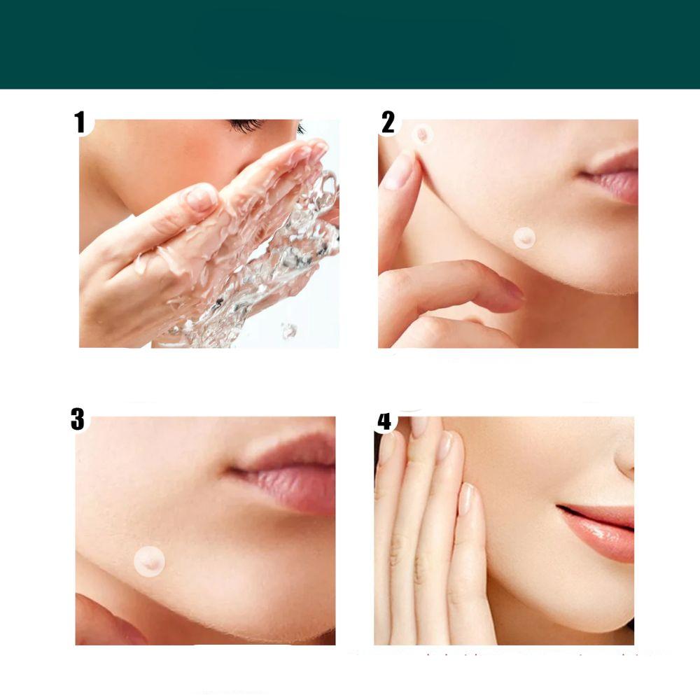 Stornfield | SkinClear - Plaster for the removal of spots and warts