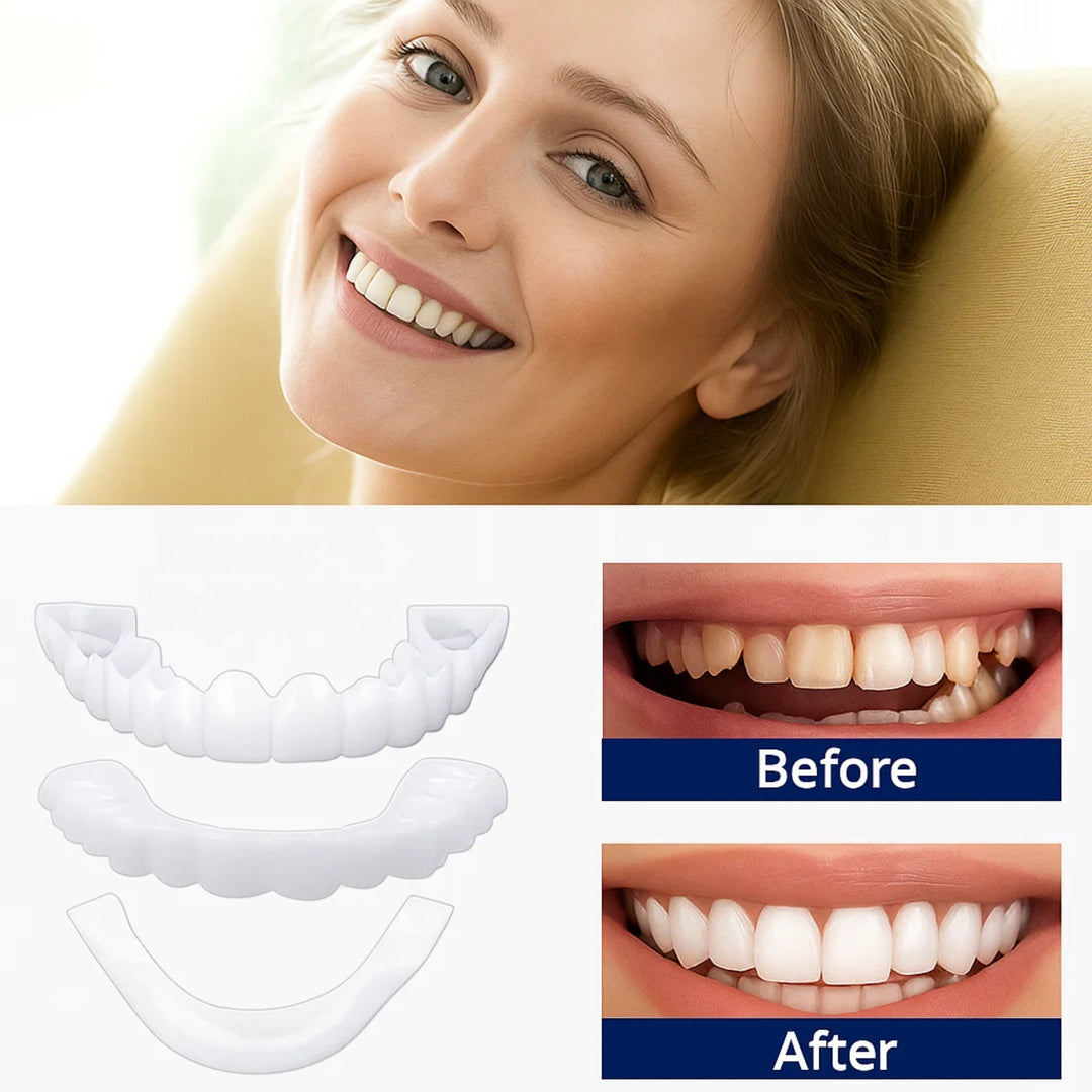 SmileEase | Clip-On Veneers – Instant Smile Enhancement – Ultra-Thin Design – Ideal for Adults Seeking Affordable Dental Solutions Stornfield