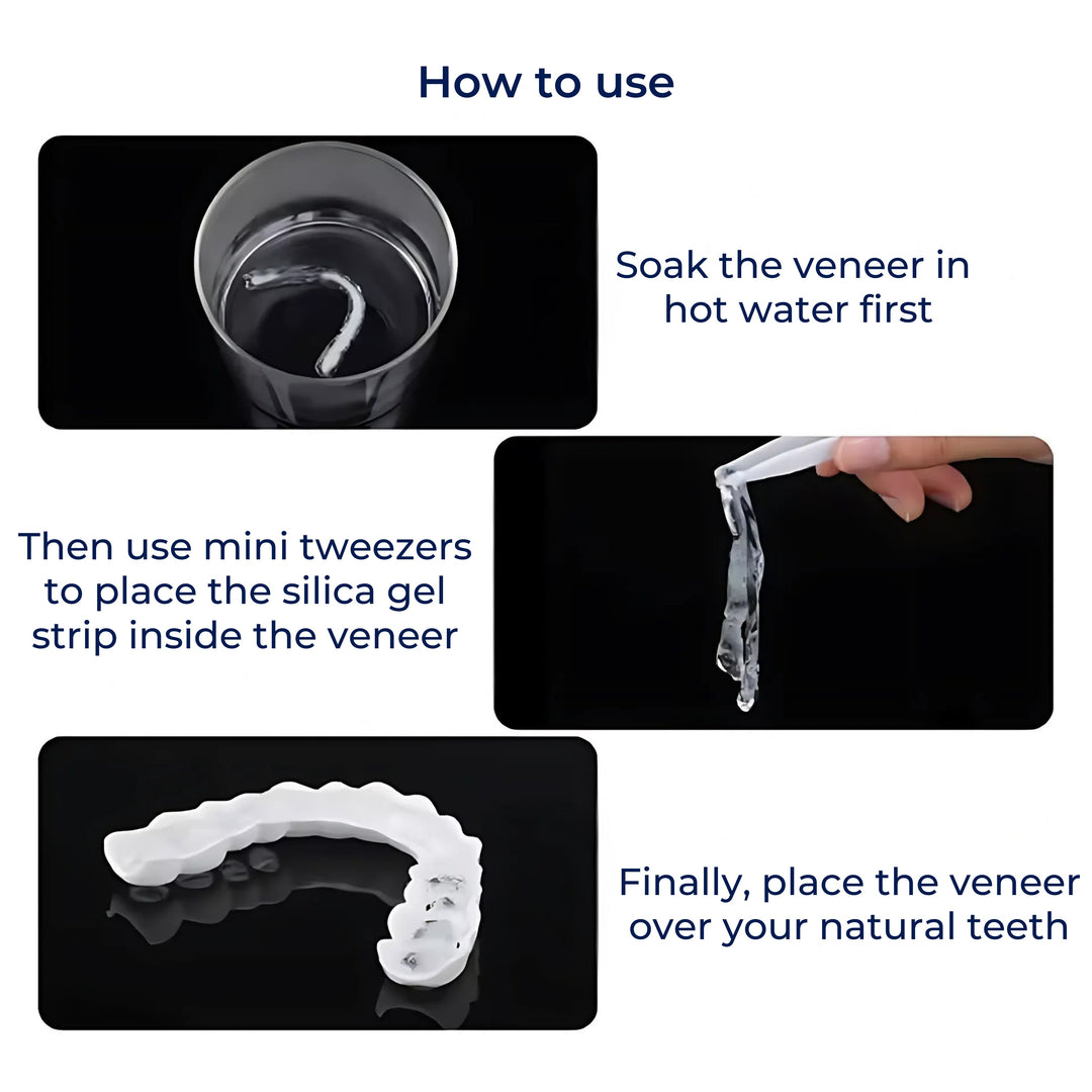 SmileEase | Clip-On Veneers – Instant Smile Enhancement – Ultra-Thin Design – Ideal for Adults Seeking Affordable Dental Solutions Stornfield