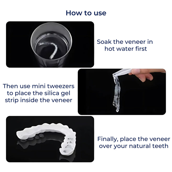 SmileEase | Clip-On Veneers – Instant Smile Enhancement – Ultra-Thin Design – Ideal for Adults Seeking Affordable Dental Solutions Stornfield