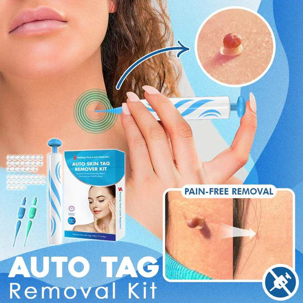 Stornfield | Quick Release Kit