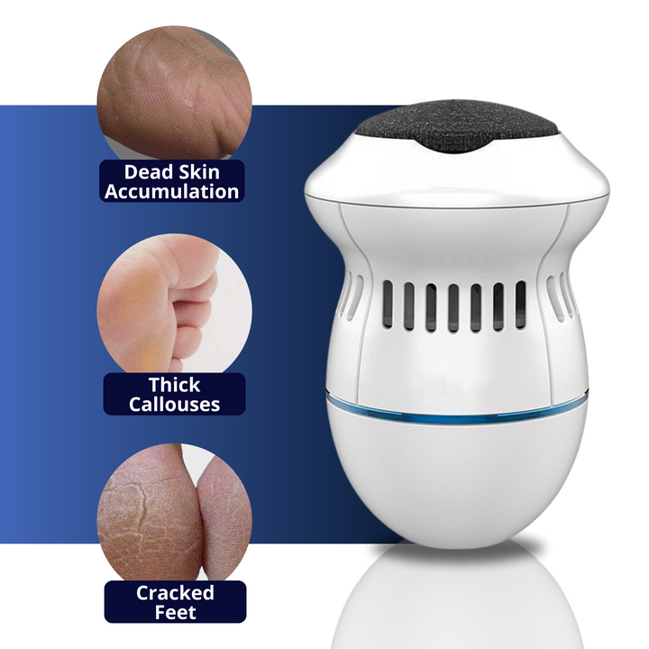 Electric Foot Care Professional | No More Calluses! | Stornfield
