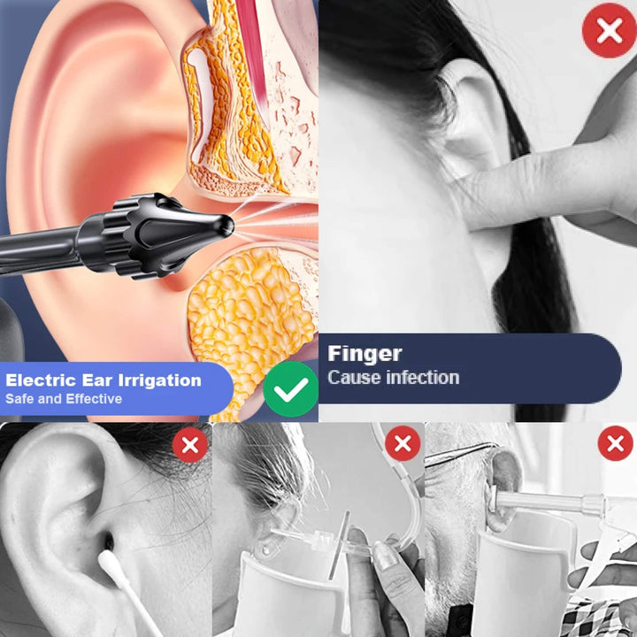 Stornfield | Wush Pro Ear Cleaner – Effective Ear Cleaning Solution for Cleaner, Healthier Ears