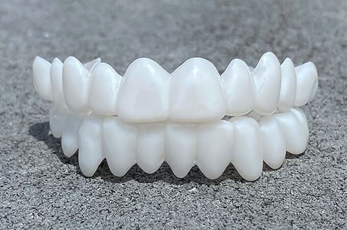 Stornfield | Dental prosthesis with white dental lenses