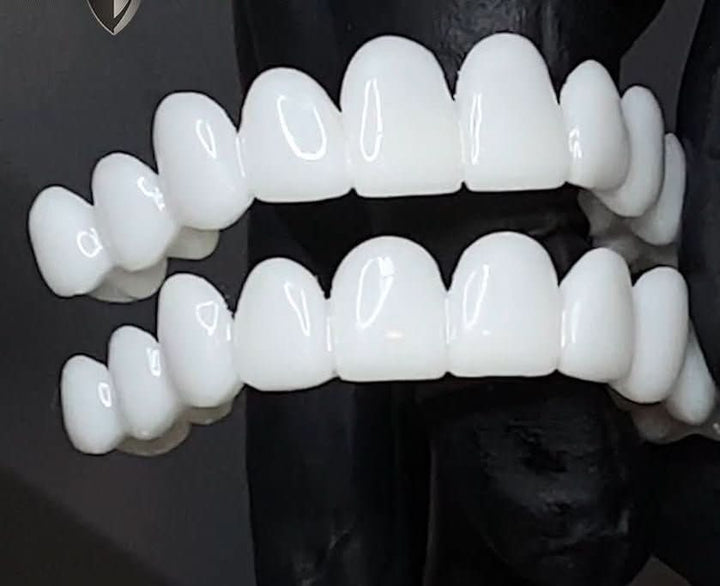 Stornfield | Dental prosthesis with white dental lenses