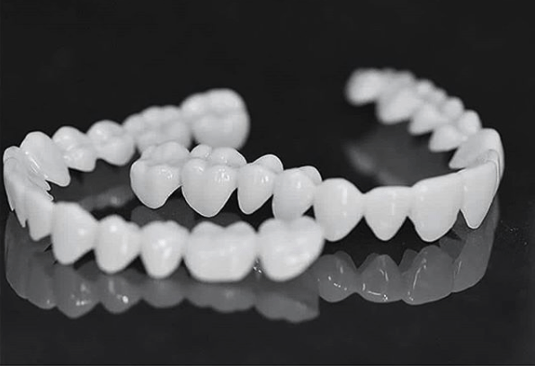 Stornfield | SmileFlex Dental Prosthesis with White Veneers