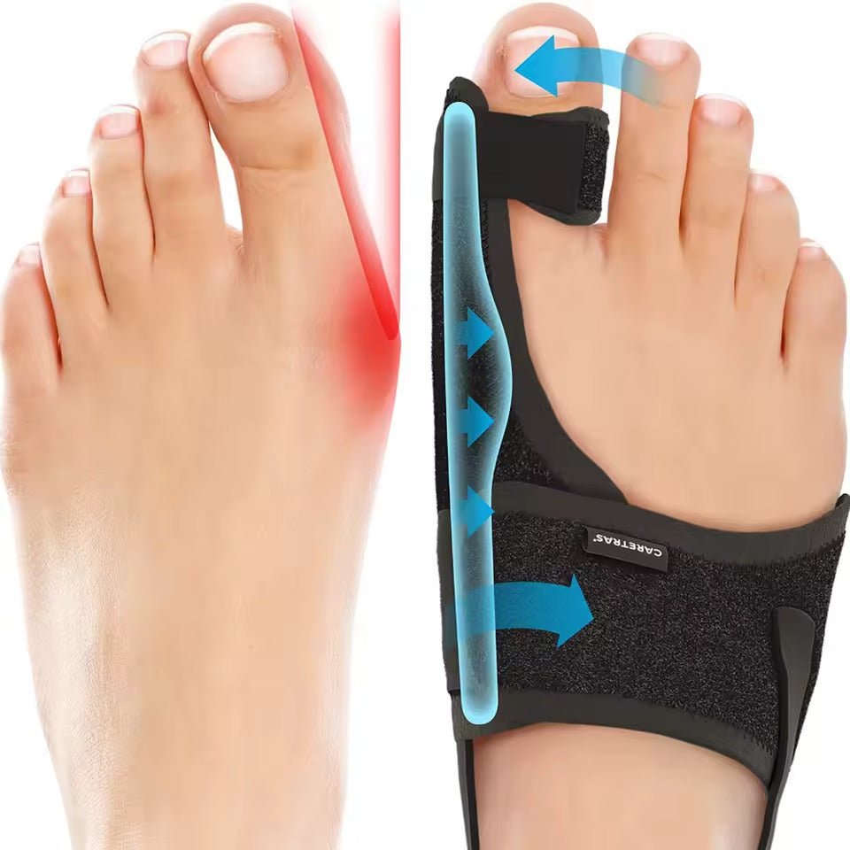 Stornfield | Night Splint Hallux Valgus - Ergonomic and Adjustable Comfort