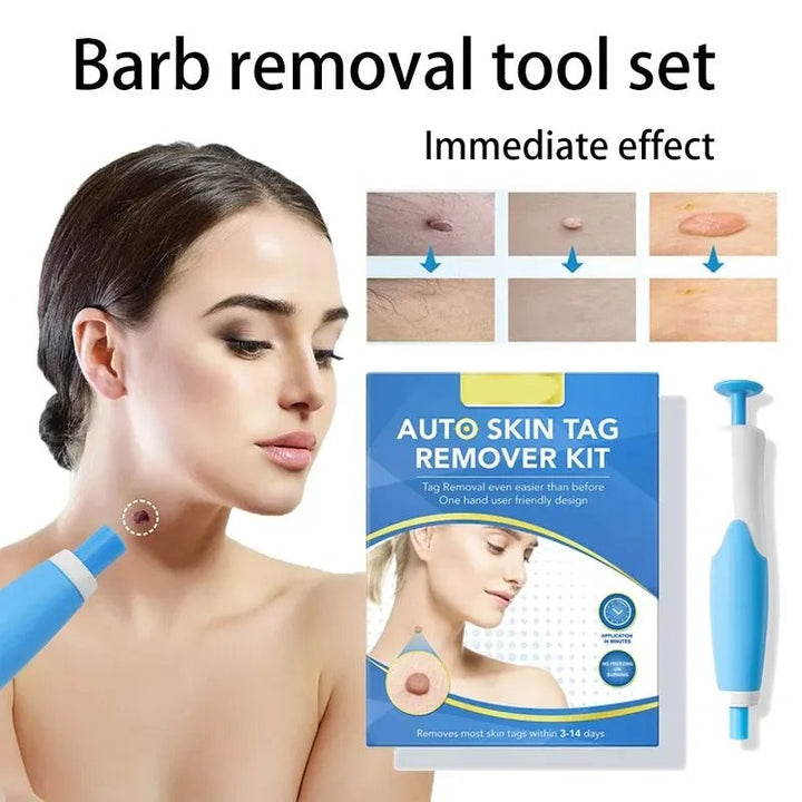 Stornfield | Ingrown Hair Removal Kit