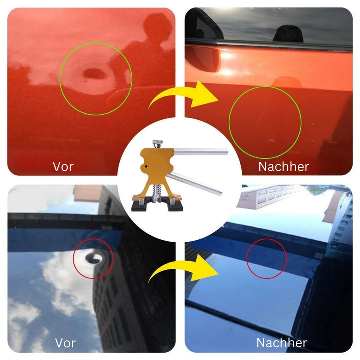 DeukFix Repair Set – Car Dents Removal Without Paint Damage | Stornfield