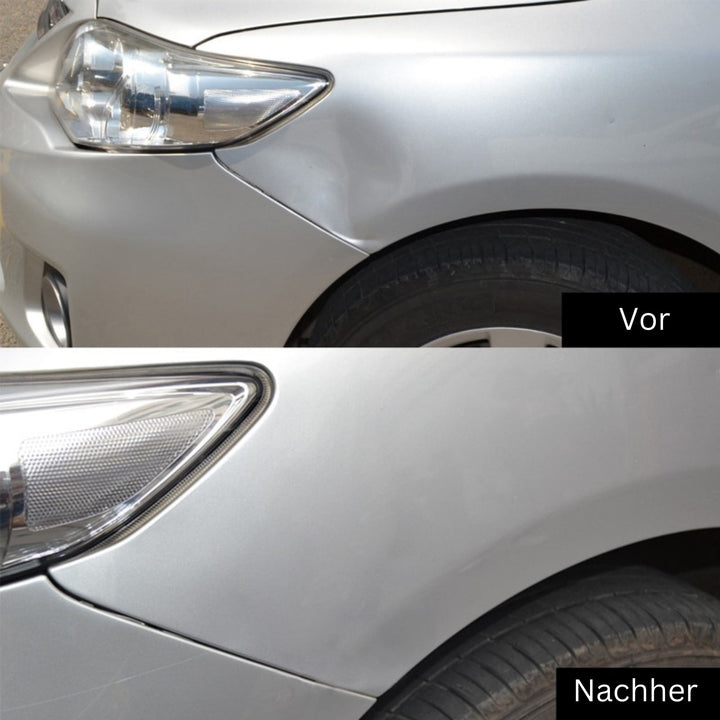 DeukFix Repair Set – Car Dents Removal Without Paint Damage | Stornfield