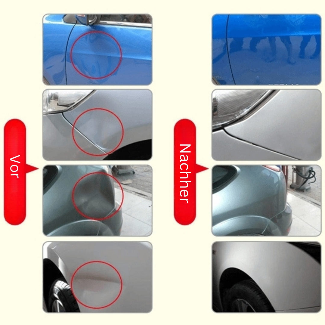 DeukFix Repair Set – Car Dents Removal Without Paint Damage | Stornfield