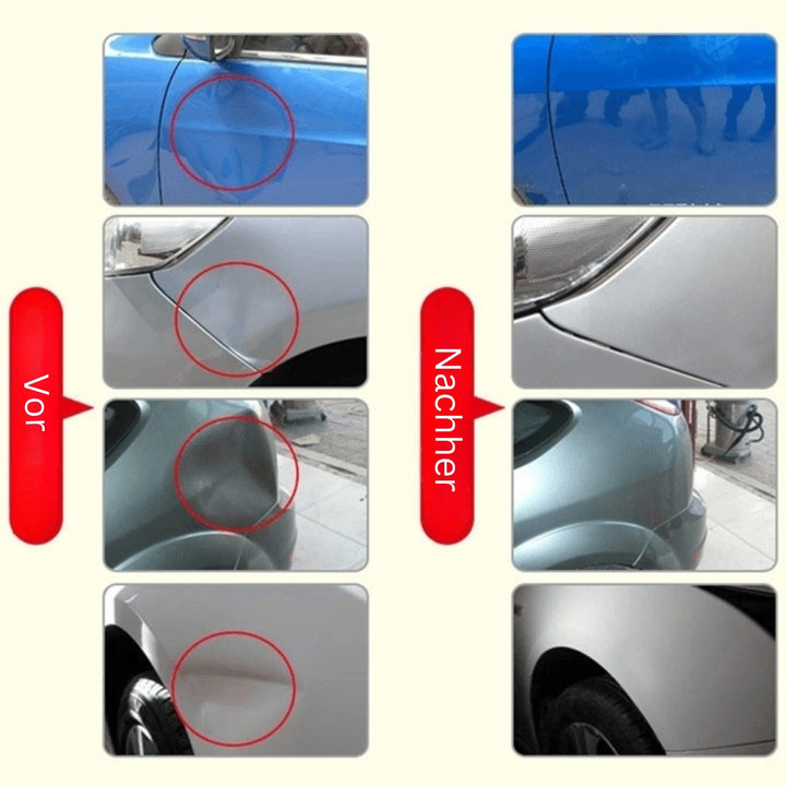 DeukFix Repair Set – Car Dents Removal Without Paint Damage | Stornfield