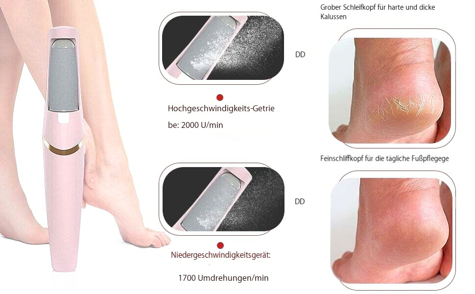 Tool for Smooth Feet | Effortlessly Remove Calluses | Stornfield