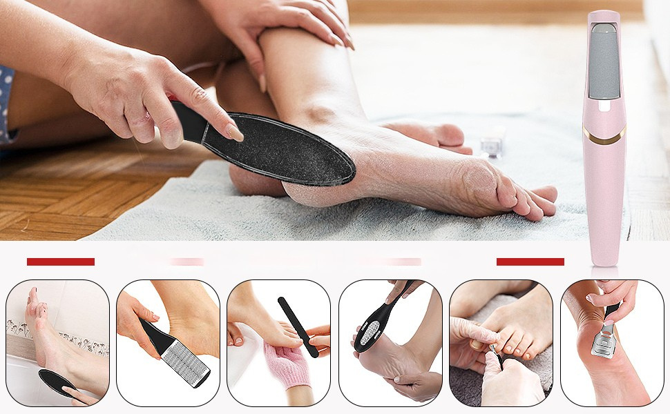 Tool for Smooth Feet | Effortlessly Remove Calluses | Stornfield