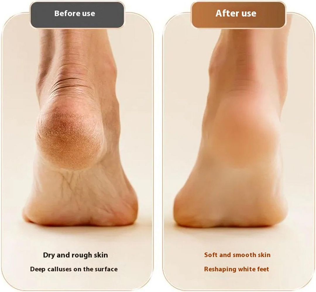 Electric Foot Care | Smooth Feet at Home | Stornfield