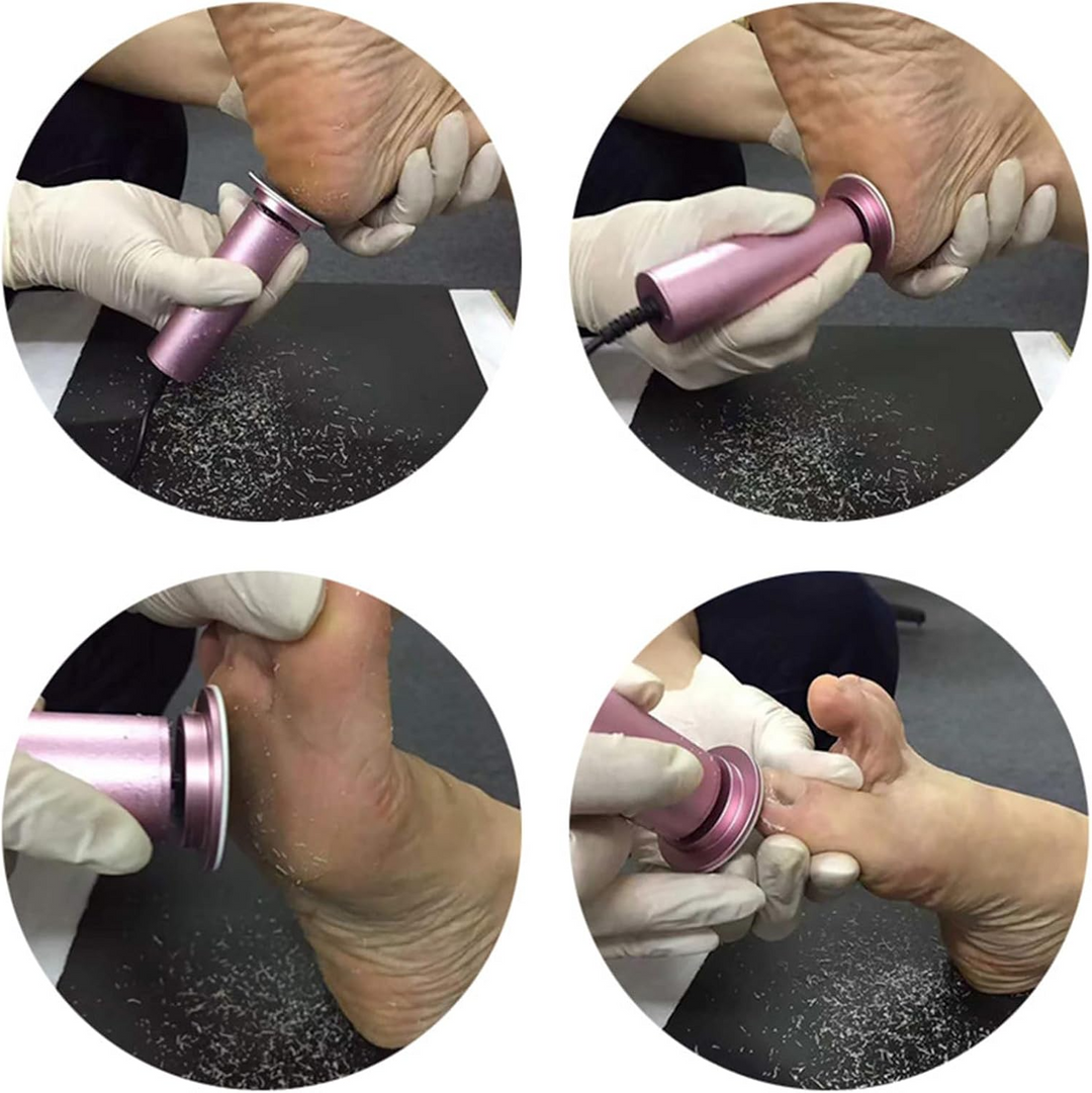 Gentle callus removal | Strong protection for your feet | Stornfield