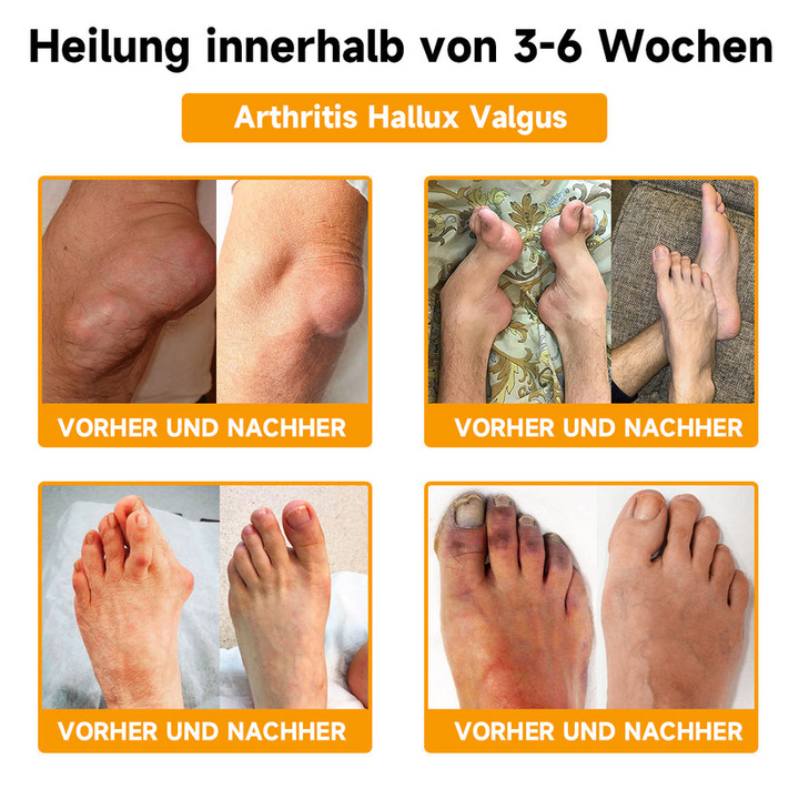 Bienen-Vital-Creme | Quick Pain Relief | Stornfield
