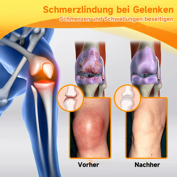 Bienen-Vital-Creme | Quick Pain Relief | Stornfield