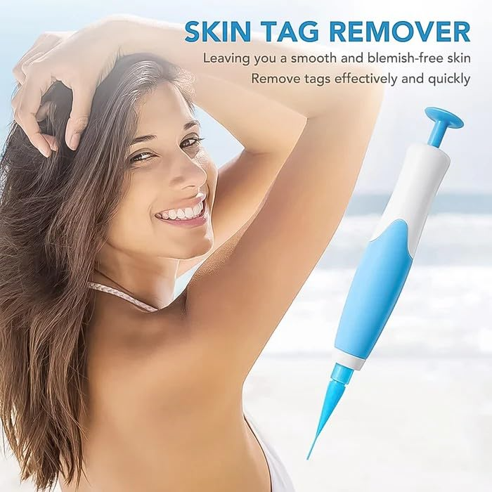 Skin Tag Remover Kit | Non-invasive & Effective | Stornfield