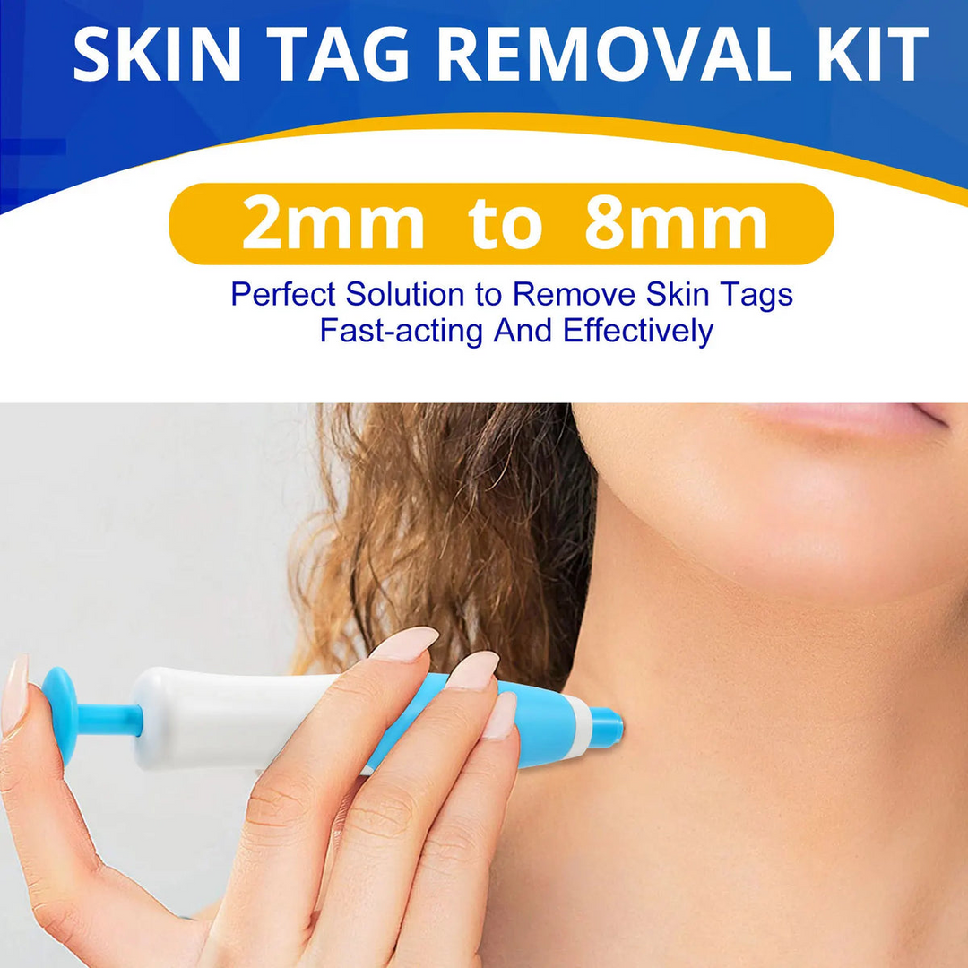 Skin Tag Remover Kit | Non-invasive & Effective | Stornfield