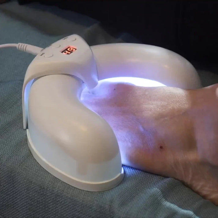 Nail therapy device | Home use, medication-free, nail fungus solution | Stornfield