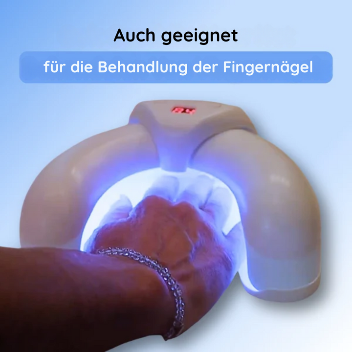 Nail therapy device | Home use, medication-free, nail fungus solution | Stornfield