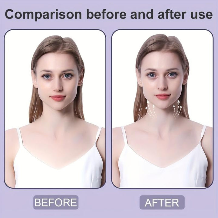 Stornfield | Neck Lifting Tape | Instant Firming & Sculpting Effect | Invisible & Skin-Safe Adhesive
