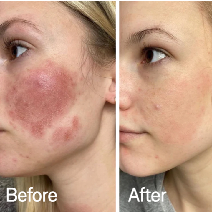 VitaleSkin Mask | Stornfield