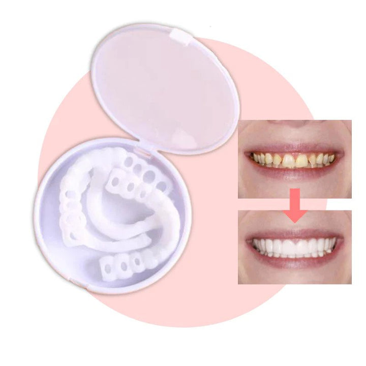 Stornfield | SmileSnap - Always the perfect smile with these veneers