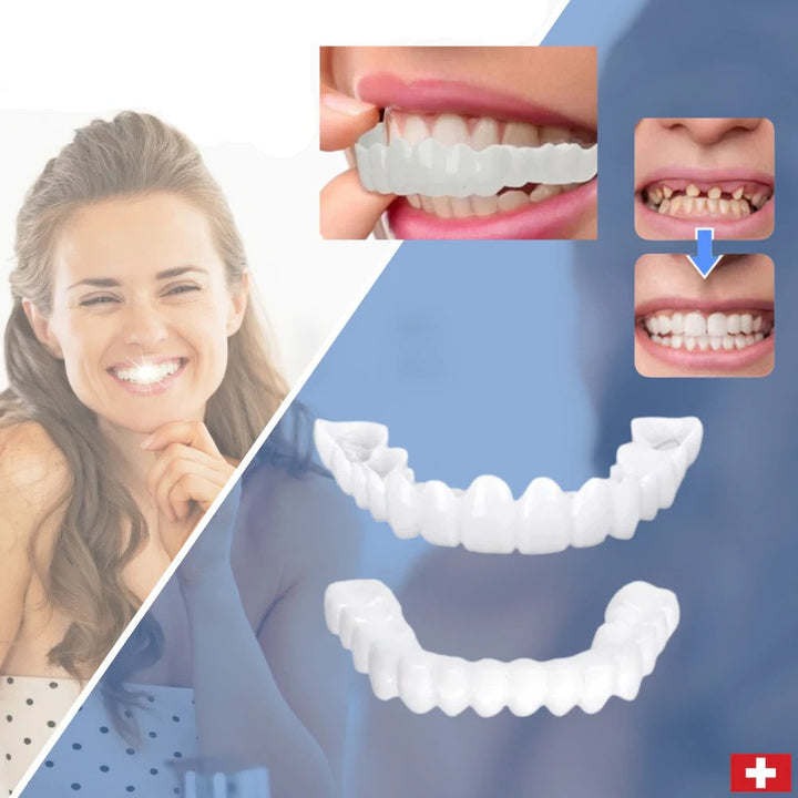 Stornfield | SmileSnap - Always the perfect smile with these veneers