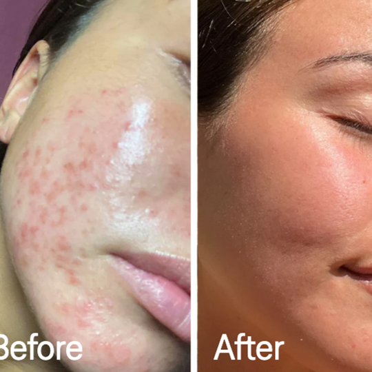 VitaleSkin Mask | Stornfield