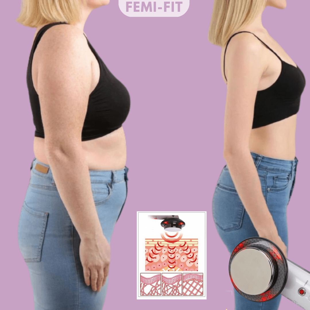 Stornfield | 3-in-1 Cellulite and Fat Burner with EMS, Ultrasound & Infrared