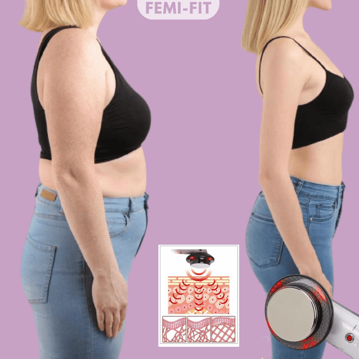 Stornfield | 3-in-1 Cellulite and Fat Burner with EMS, Ultrasound & Infrared