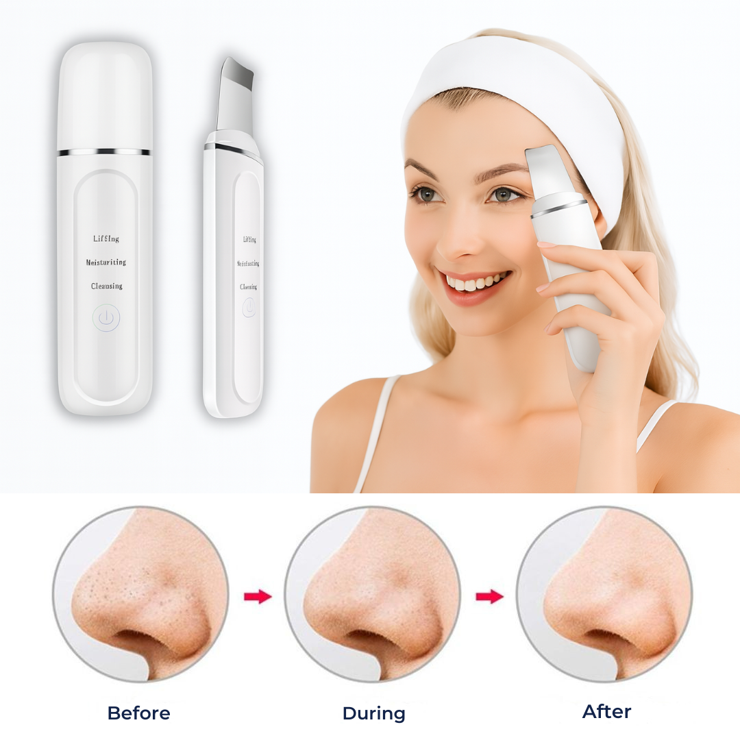 GlowSonic | Ultrasonic Facial Wand - Deep Cleansing - 33,000 Vibrations - At-Home Skincare Tool Stornfield