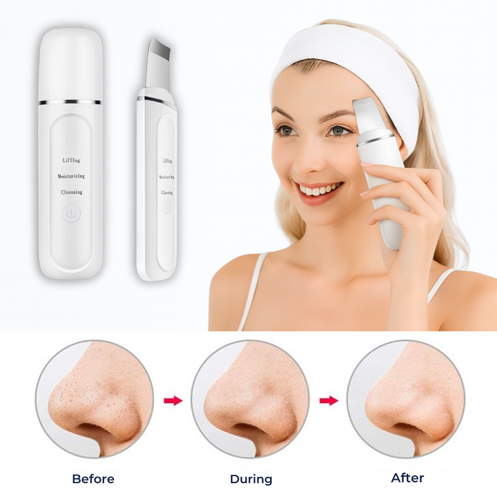 GlowSonic | Ultrasonic Facial Wand - Deep Cleansing - 33,000 Vibrations - At-Home Skincare Tool Stornfield