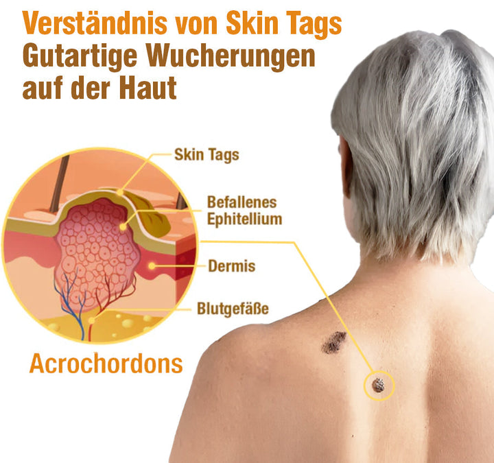 TagRecede Bee Gift Spray | Natural Skin Perfection | Stornfield