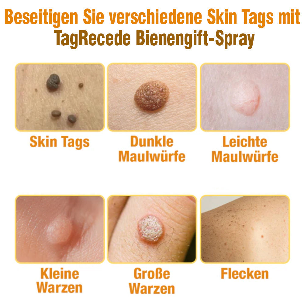 TagRecede Bee Gift Spray | Natural Skin Perfection | Stornfield