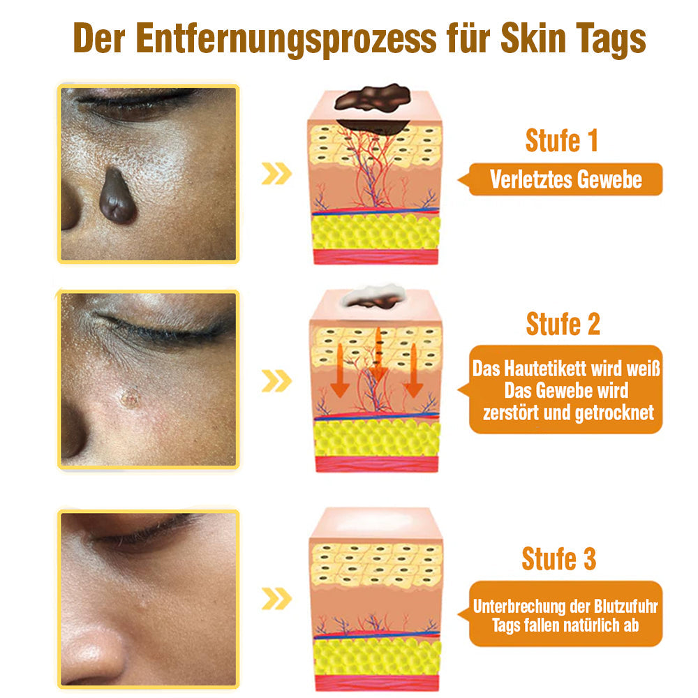 TagRecede Bee Gift Spray | Natural Skin Perfection | Stornfield