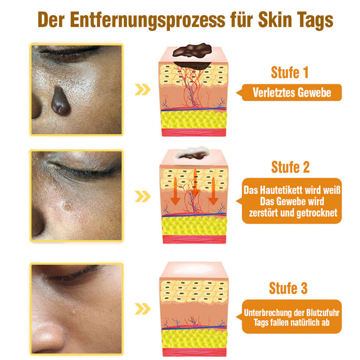 TagRecede Bee Gift Spray | Natural Skin Perfection | Stornfield
