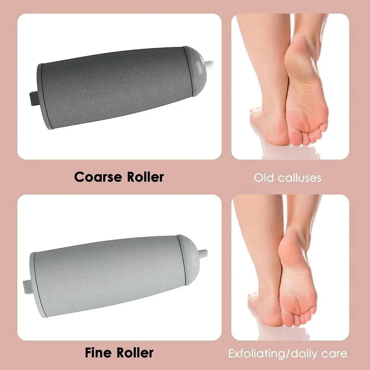 Advanced electric callus remover for smooth feet | Stornfield
